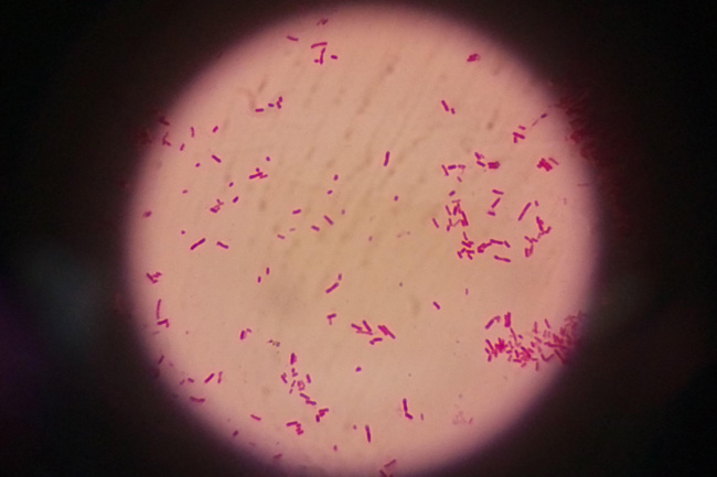显微镜下大肠杆菌