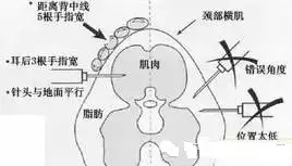 发酵料