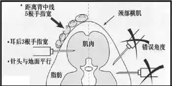 新康科技